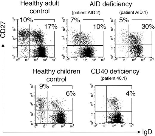 Figure 3. Presence of an IgM+IgD+CD27+ subset in hyper-IgM patients. Patients AID.1 and 40.1 have been reported previously.20,21 Control is an 11-year-old child, age-matched with patient 40.1. Since IgD+CD27+cells coexpress IgM, the IgM+IgD+CD27+ subset is analyzed after IgD, CD27, and CD19 labeling of purified B cells. IgD and CD27 expression is shown after gating on CD19+ cells. Percentages of cells in the naive and the 2 CD27+ quadrants are indicated.