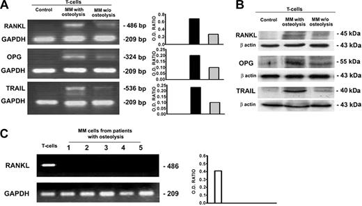 Figure 4. Cytokine expression by fresh T and MM cells. Fresh T cells purified from PBMCs of patients with MM with or without osteolysis as well as from controls were analyzed for RANKL, OPG, and TRAIL expression, respectively, by RT-PCR (A) and Western blotting (B). MM cells purified from BM of patients with MM with osteolysis were analyzed for RANKL expression by RT-PCR (C). The results show the overexpression of RANKL, OPG, and TRAIL by fresh T cells from patients with MM with osteolysis compared with those without osteolysis and controls (A-B). MM cells were found not expressing RANKL (C). The intensity of the bands obtained by RT-PCR was quantified by densitometry (histograms) and normalized to GAPDH.