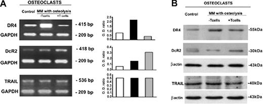Figure 6. OC expression of TRAIL and its receptors. OC expression of TRAIL and its death (DR4) and decoy (DcR2) receptors was analyzed by RT-PCR (A) and Western blotting (B). Fully differentiated OCs were obtained in unfractionated as well as T-cell–depleted MM PBMC cultures (the latter following the addition of M-CSF and RANKL). The OCs generated in the absence of T cells overexpressed TRAIL DR4 receptor at both mRNA (A) and protein levels (B). On the contrary, the OCs from T-cell–depleted cultures overexpressed DcR2 at both mRNA (A) and protein levels (B). No significant difference was found in TRAIL expression. The intensity of the bands was quantified by densitometry (histograms) and normalized to GAPDH.