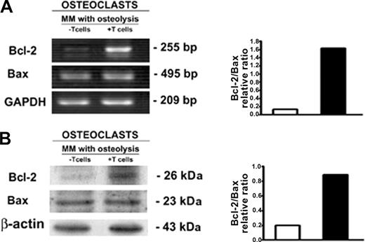 Figure 7. OC expression of Bcl-2 and Bax. The analysis of Bcl-2 and Bax expression by OCs, developed in unfractionated as well as T-cell–depleted PBMC cultures derived from patients with MM with osteolysis, was performed by RT-PCR (A) and Western blotting (B). T-cell–depleted cultures were stimulated with exogenous M-CSF and RANKL. The intensity of the bands was quantified by densitometry. The graphs represent the mean optical density (OD) of Bcl-2/Bax ratio normalized to the OD of GAPDH or β-actin of a representative experiment for RT-PCR and Western blotting, respectively. Bcl-2 is highly expressed in the OCs obtained in the presence of T cells.