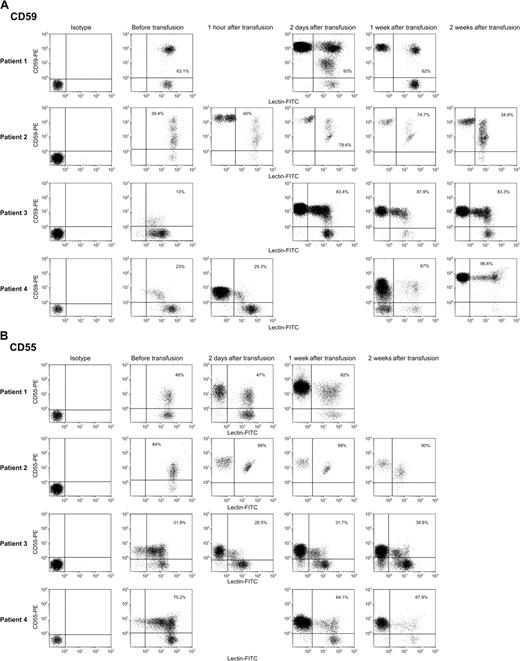 Figure 2. CD59, and to a lesser extent CD55, are transferred to deficient RBCs in PNH patients following transfusion. Erythrocytes were washed as described in “Patients, materials, and methods” and stained with FITC-conjugated Dolichos biflorus and either PE-conjugated mAbs to CD55 or CD59. Above are scattergrams showing isotype controls stained with PE-IgG and staining of group A1 donor cells with PE-CD59 mAb (A) and PE-CD55 mAb (B) before transfusion and at varying intervals following transfusion. The transfused cells, which were lectin negative, appear in the posttransfusion samples, but transfer was not seen in the samples obtained 1 hour after transfusion. The percentages in the right upper quadrant of the scattergrams reflect lectin-positive cells (ie, group A1 patient cells), which are CD59+ or CD55+. Transfer of CD59 appeared to be more efficient than transfer of CD55.