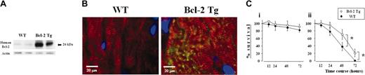 Figure 1. Expression and effects of human Bcl-2 on cardiomyocytes from transgenic mice. (A) Western blot analysis of human Bcl-2 in heart lysates of naive Bcl-2 Tg (n = 2) and WT (n = 2) mice. Increased expression of human Bcl-2 was observed in the transgenic group. (B) Bcl-2 expression in cardiomyocytes. Heart sections were costained with antihuman Bcl-2 recognized by FITC-conjugated secondary antibody (green) and anti-α actinin recognized by Texas red–conjugated secondary antibody (red) antibodies. Sections were counterstained with 4,6-diamidino-2-phenylindole (DAPI, blue). Striations, within the cardiomyocyte, consistently displayed α-actinin staining throughout the entire cell. Human Bcl-2, located exclusively within the cytoplasm of the cardiomyocyte, was identified only in hearts from Bcl-2 Tg mice. A Leica DMRB fluorescent microscope (Leica Microsystems, Frankfurt, Germany) and SPOT Advanced Version 3.4.2 software (Diagnostic Instruments, Sterling Heights, MI) were used. Original magnification, × 400. (C) Effect of human Bcl-2 overexpression on cardiomyocyte survival. Cardiomyocytes from human Bcl-2 Tg (n = 3) and WT (n = 3) mice were cultured in the presence (i) or absence (ii) of 10% fetal calf serum. The percentage of surviving cells was assessed by the trypan blue exclusion assays at the indicated time points. Data are shown as the percentage of surviving cells against the number of initial plated cells and are representative of 2 independent experiments. Data are shown as mean ± SD. *P < .01.