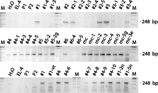 Figure 3. PCR analysis of GCV-sensitive and GCV-resistant cells. The PCR reaction detects LTR sequences of the retroviral vector.20 Tumors with a negative Southern blot (TK probe; data not shown)23 and a positive PCR reaction were numbers 2-1, 2-5, 3-4, and 5-2. Clones with ambiguous results were repeatedly analyzed. Starting material for PCR was gDNA; M, 100-bp ladder DNA marker; EL-4, untransduced EL-4 cell gDNA; P1 and P2, primers LTR1 and LTR2 tested on number 1 gDNA; g, a split from isolated tumor cells had been cultivated further and was selected additionally with G418 before gDNA extraction; mc-1 to mc-5, tumor cells isolated from relapsed mice that originally received transplants of vector-transduced mass culture (mc) cells; e, tumor cells had been isolated from mice that were treated with GCV beginning one day after tumor cell inoculation; vt, EL-4 cells isolated after GCV selection in vitro; and n, tumor cells isolated from mice that had not been treated with GCV. DNA from clones with a negative result in the LTR-PCR was successfully amplified using primers annealing to the endogenous Xist gene (see “PCR” in “Materials and methods”).