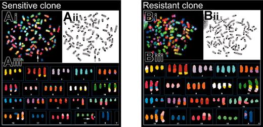 Figure 4. Spectral karyotyping shows loss of transduced chromosome in relapsed tumor. Spectral karyotyping (SKY analysis) of metaphases from a GCV-sensitive and a GCV-resistant clone. (Ai, Bi) Original RGB (red-green-blue) image after acquisition; (Aii, Bii) inverted DAPI image showing chromosome banding; and (Aiii, Biii) SKY karyotype after chromosome classification. (Aiii) The sensitive cell showed 3 normal chromosomes 19 and a Der(19)T(6B;19D) (arrow); (Biii) the resistant cell revealed 4 normal chromosomes 19 and has thus lost the marker Der(19)T(6B;19D). The complete karyotype is provided in Table 2.