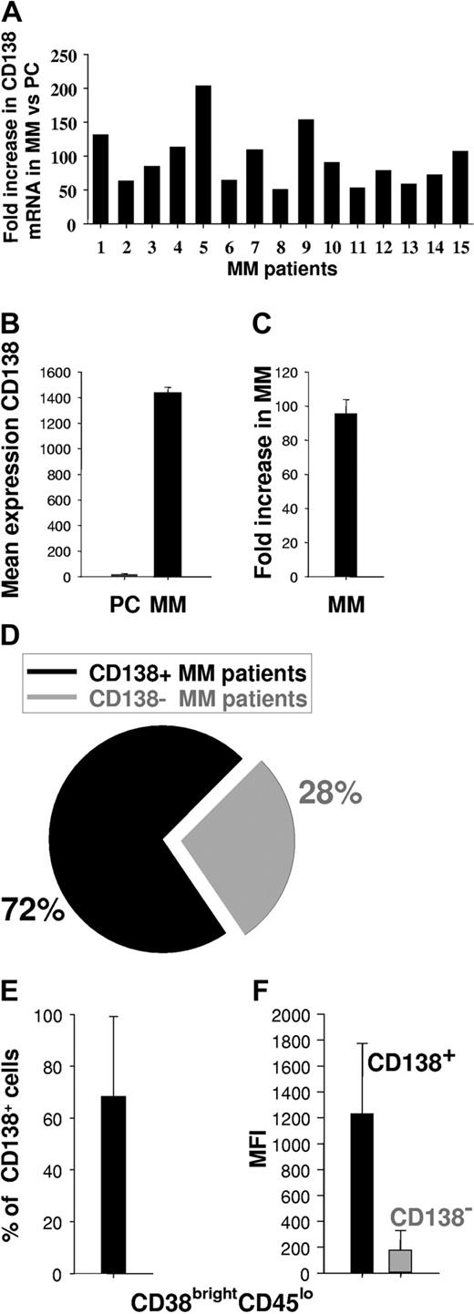 Figure 1. Expression of CD138 in MM. (A) Individual fold increase in intensity of CD138 gene expression (transcription) in patient MM cells (15 patients) compared with normal PCs (n = 3 individuals). (B) Mean intensity of CD138 gene expression in normal PCs (n = 3) and patient MM cells (n = 15). (C) Mean fold increase intensity of CD138 gene expression in MM cells (n = 15) versus normal PCs (n = 3). (D) Percentage of patients expressing CD138+ MM cells, as determined by flow cytometry on fresh BM aspirate samples. (E) Percentage of CD138+ MM cells in CD138+ patients as determined by flow cytometry on fresh BM aspirates. (F) MFI of CD138+ or CD138- MM cells within CD38brightCD45lo population, as determined by flow cytometry. Error bars indicate standard deviation (SD).