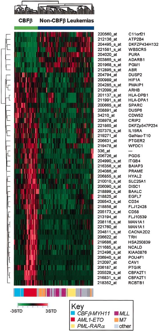 Figure 4. Expression signature of core-binding factor AMLs. Two-dimensional hierarchical clustering of the 130 AML cases using the top 50–ranked discriminating probe sets for the core-binding factor (CBF) leukemias (AML1-ETO and CBFβ-MYH11 cases). The genetic subtype of each case is presented by a color-coded bar at the bottom of the figure, using the same color scheme used in Figures 1, 2, 3. The probe set number and gene symbol for the discriminating genes are listed on the right. The normalized expression level for each gene is represented by a color using the scale shown in the lower left corner. Cases were clustered using a cosine function.