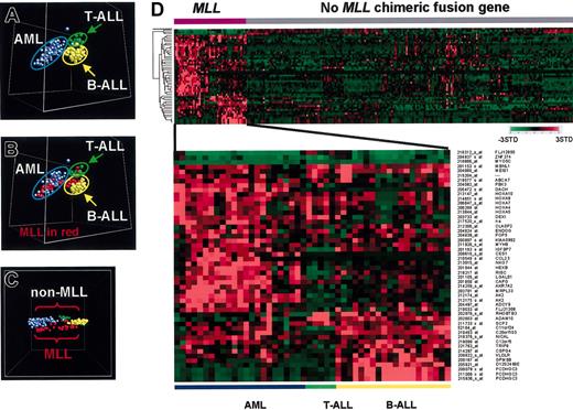 Figure 5. Gene expression profiles of pediatric acute leukemia with MLL chimeric fusion genes. (A) Multidimensional scaling plot generated using unsupervised principle components analysis with a combined data set containing 130 AML cases, 132 ALL cases,41 and 5 additional T-lineage ALL (T-ALL) cases that contain MLL chimeric fusion genes. A variation filter was applied to remove any probe sets that showed minimal variation in expression across this data set, and the analysis was performed with the remaining 17 944 probe sets. Each case is represented by a colored sphere, with AML cases indicated by blue, B-progenitor lineage ALL (B-ALL) by yellow, and T-ALL by green. Acute leukemia cases cluster based on lineage. (B) The same PCA analysis as shown in panel A, except that cases that contain an MLL chimeric fusion gene are indicated in red. The cases containing the MLL chimeric fusion gene continue to cluster according to lineage. (C) Multidimensional scaling plot generated using the supervised learning algorithm, discriminants analysis with variance (DAV) with the expression data from the 267 acute leukemia samples generated using the 17 944 probe sets that passed the variation filter. Cases are color coded as described for panel B. Cases with an MLL chimeric fusion gene (in red) can be separated in gene space from the leukemias that lack this genetic lesion. (D) Expression profile of the top 50–ranked MLL discriminating genes. The probe set number and gene symbol for the discriminating genes are listed on the right. The normalized expression level for each gene is represented by color using the scale shown.