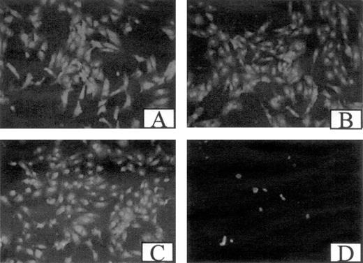 Figure 4. Effect of antibodies and peptides on cell adhesion. Confluent ECs plated on gelatin-coated coverslips were incubated in McCoy 5A medium (A), with 5 μg/mL 7E3 (B), 1 mM GRGDS (C), or 5 μg/mL α5β1 antibody (D). After 24 hours, the cells were fixed, washed with PBS twice, stained with propidium iodide, and the coverslips were viewed under a fluorescence microscope.