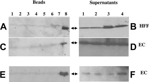 Figure 5. Colocalization of αvβ3 and FGFR1 using coimmunoprecipitation. ECs or HFFs were exposed to various conditions, as described. After 1 hour, cells were washed with PBS, lysed with lysis buffer, and incubated with 5 μg/mL of either 7E3 (A-D) or anti-FGFR1 (E-F). Protein A–Sepharose beads were then added. Following washing, the beads were incubated with diluent and electrophoresed on 10% gels. Western blotting was performed with anti-FGFR1 (A-D) or with 7E3 (E-F). In panels A, C, and E: lane 1, medium alone; lane 2, 100 ng/mL FGF-1; lane 3, 100 ng/mL FGF-2; lane 4, 10 μg/mL fibrinogen; lane 5, 10 ng/mL IL-1β; lane 6, 100 ng/mL FGF-1 plus 10 μg/mL fibrinogen; lane 7, 10 ng/mL IL-1α plus 10 μg/mL fibrinogen; lane 8, 100 ng/mL FGF-2 plus 10 μg/mL fibrinogen. Panels B, D, and F are supernatants after centrifugation of protein A–Sepharose: lane 1, medium alone; lane 2, 10 μg/mL fibrinogen; lane 3, 100 ng/mL FGF-2; lane 4, 100 ng/mL FGF-2 plus 10 μg/mL fibrinogen. Arrows indicate the location of FGFR1 (Mr ∼100 kDa) in panels A-D; the arrows indicate the location of αvβ3 in panels E-F (Mr ∼110 kDa).