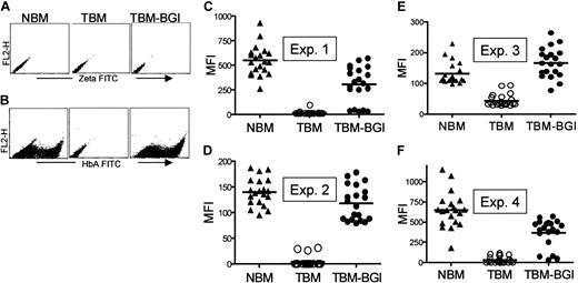 Figure 3. High-level gene transfer and β-globin production in individual BFUe's from thalassemia major bone marrow transduced with the BGI vector. Individual BFUe's were picked at 2 weeks and HbA analysis performed after intracellular labeling of half the colony with human zeta-globin (A) as a negative control and the other half with HbA (B) and analyzed by FACS. Panels C to F show the MFI from 20 individual BFUe colonies from NBM, TBM, and TBM-BGI from experiments 1, 2, 3, and 4 respectively. The average MFIs ± SEMs of HbA were as follows: experiment 1, NBM 549 ± 34, TBM 17 ± 4, TBM-BGI 304 ± 41; experiment 2, NBM 140 ± 6, TBM 4 ± 2, TBM-BGI 118 ± 4; experiment 3, NBM 132 ± 8, TBM 44 ± 5, TBM-BGI 167 ± 11; experiment 4, NBM 650 ± 49, TBM 33 ± 9, TBM-BGI 369 ± 39. The horizontal lines in panels C-F represent the average MFI of the 20 BFUe's in that group.