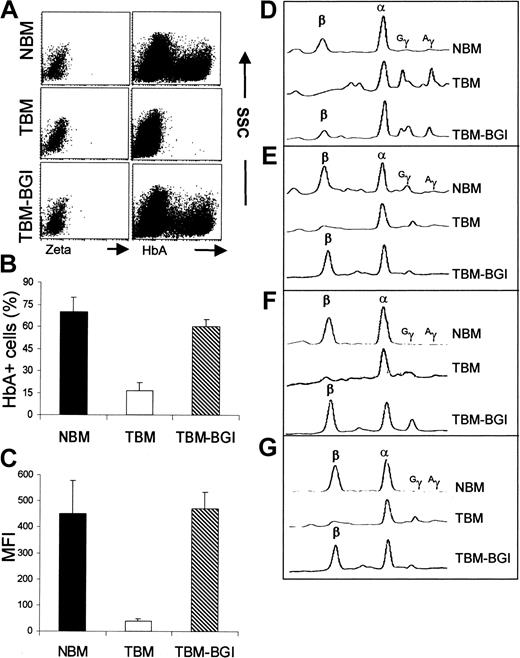 Figure 4. Normal levels of HbA and β-globin production in transduced thalassemia bone marrow erythroid liquid cultures. (A) FACS analysis of a 12-day erythroid culture from NBM, TBM, and TBM-BGI with the panels on the left showing the negative controls labeled with zeta-globin and the panels on the right showing HbA labeling. (B) The mean proportion (mean ± SEM; n = 4) of HbA+ cells in culture between days 10 and 12 was 70% ± 11% in NBM, 16% ± 6% in TBM, and 60% ± 5% in TBM-BGI; P < .001 NBM versus TBM, P < .2 NBM versus TBM-BGI. (C) The MFI of HbA in the same cultures was 451 ± 141 in NBM, 39 ± 8 in TBM, and 469 ± 72 in TBM-BGI; P < .001 NBM versus TBM, P = .45 NBM versus TBM-BGI. (D-G) Reverse phase HPLC analysis on the cells from liquid cultures done at 2 weeks of culture from the 4 individual experiments showing the β, α, Gγ, and Aγ globin chains marked in NBM, TBM, and TBM-BGI.