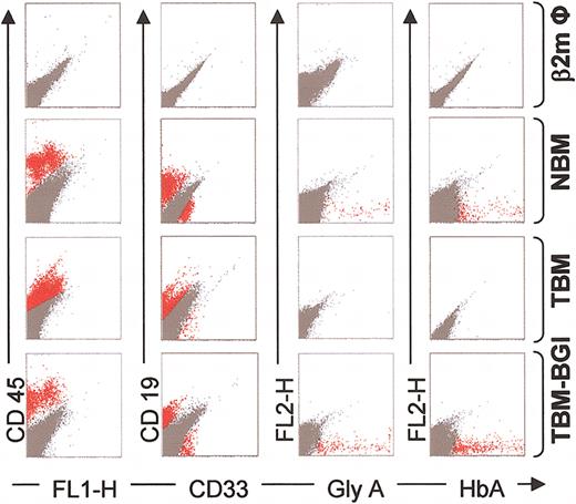 Figure 5. Multilineage engraftment and β-globin expression in β2mnull NOD-SCID mice. FACS analysis of β2mnull NOD-SCID mouse bone marrow, performed 12 to 16 weeks following transplant with human CD34+ cells: β2m Φ (no human cells, row 1), NBM (mock transduced, row 2), TBM (mock transduced, row 3), and TBM-BGI (BGI transduced, row 4). Representative dot-plots showing human CD45 (y-axis, column 1), human CD19 (y-axis, column 2), human CD33 (x-axis, column 2), and human glycophorin A (x-axis, column 3) expression from one mouse in each group. Bone marrow also was labeled intracellularly with HbA Ab, and dot-plots showing HbA expression in the bone marrow of these mice (x-axis, column 4) are shown. All samples in columns 1 to 3 were gated on the basis of appropriate isotype controls, and events falling within the isotype control gate are shown in dark gray. All events labeled positive with the respective human antibodies are shown in red. For intracellular HbA staining, human zeta-globin was used as the negative control, and events falling within this gate are shown in dark gray. HbA-labeled events falling outside this gate are shown in red.