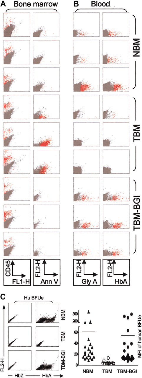 Figure 6. Restoration of effective erythropoiesis and normal HbA production in xenografts. Representative dot-plots of 3 β2mnull NOD-SCID mice from each group (NBM, TBM, TBM-BGI) 12 to 16 weeks following transplantation. (A) Bone marrow labeled with anti–human CD45 Ab (column 1) showing human cell engraftment and showing apoptotic cells labeled with annexin-V (column 2). (B) Blood from the same mice was labeled with anti–human Ab to glycophorin A (column 3), showing circulating human erythroid cells. Blood also was labeled with anti–human HbAAb (column 4). All samples in columns 1 to 3 were gated on the basis of appropriate isotype controls, and events falling within this gate are shown in dark gray. All events labeled with the respective human antibodies are shown in red. For intracellular HbA staining, anti–human zeta-globin Ab was used as the negative control, and events falling within this gate are shown in dark gray. HbA-labeled events falling outside this gate are shown in red. (C) FACS analysis for HbA on individual human BFUe derived from human progenitors sorted from xenograft bone marrow. The top panel shows representative BFUe's from NBM, TBM, and TBM-BGI xenografts: zeta-globin and HbA expression are shown on the x-axes in columns 1 and 2, respectively. HbA MFI of individual BFUe's derived from different xenografts (NBM n = 20, TBM n = 11, TBM-BGI n = 23) were plotted (bottom panel). MFI of each BFUe is shown on the y-axis. The average HbA MFI of the BFUe's (plotted as a line) was NBM 62 ± 17, TBM 4 ± 1 and TBM-BGI 54 ± 17.