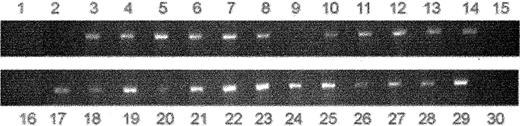 Figure 7. Provirus was present in 89% of human myeloid colonies derived from xenografted TBM-BGI mice. CFU-GM colonies were picked and PCR analysis performed on DNA using vector-specific primers: lane 1, NBM; lane 2, TBM; lanes 3 to 29, TBM-BGI; and lane 30, Φ. Vector-specific bands were seen only in the CFU-GM colonies (in 24 of 27 colonies) derived from the TBM-BGI xenografts.