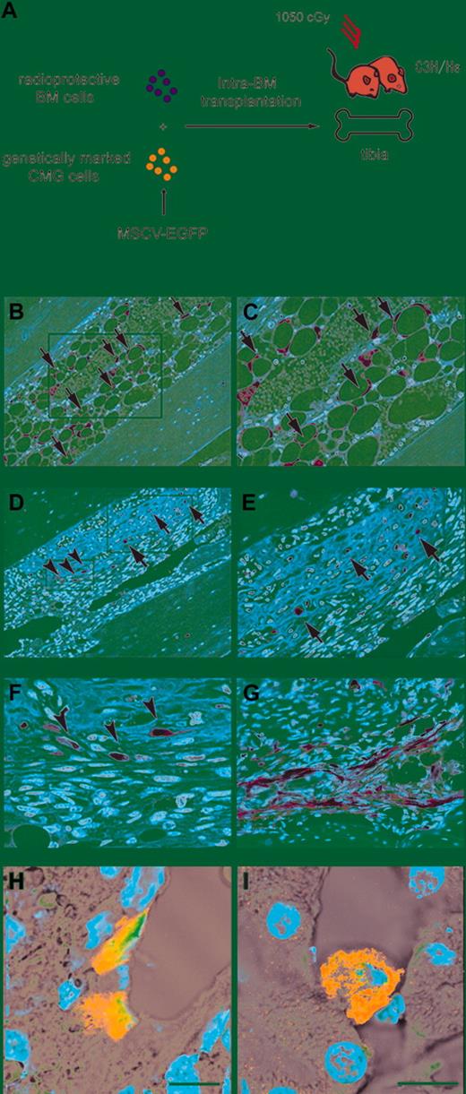 Figure 2. Engraftment and multilineage differentiation of clonal mesenchymal stem cells (CMG cells). (A) The experimental protocol for the intra-BM transplantation of CMG cells transfected with MSCV-EGFP is shown. (B-G) Transplanted CMG cells were observed in the recipients' BM. CMG cells were recognized as brown cells by immunohistochemistry. (B) CMG cells differentiated into adipocytes (arrows) (magnification, × 100). The rectangle in panel B is shown at a higher magnification (× 200) in panel C. (D) CMG cells also differentiated into osteocytes (arrows). Undifferentiated CMG cells exhibiting spindlelike shapes were also observed (arrowheads) (magnification, × 100). The rectangles in panel D are shown at higher magnifications in panels E (× 200) and F (× 400). (G) Undifferentiated CMG cells in other part (× 200). (H, I) CMG cells also were found in the liver (H) and kidney (I) by immunofluorescence photography. Bars indicate 10 μm. The green and blue signals indicate EGFP and nuclei, respectively.