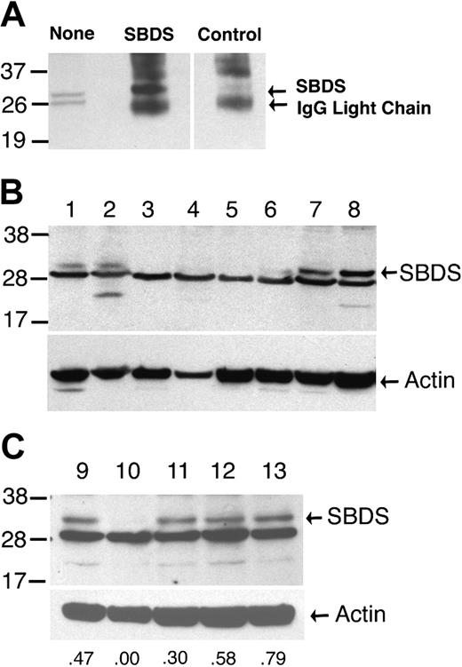 Figure 1. SBDS Western blot. (A) Proteins extracted from normal cyropreserved blood leukocytes were analyzed by immunoblotting with the SBDS antiserum either directly (none) or after immunoprecipitation with SBDS or control antiserum. There are 2 bands of approximately 29 kDa that are detected in whole-cell extracts. The upper band but not the lower band is efficiently immunoprecipitated by the SBDS antiserum, suggesting that the upper band represents the SBDS protein. (B,C) Protein extracts of cyropreserved blood leukocytes from family members in the registry were analyzed by immunoblotting with the SBDS antiserum (upper panels) or an actin antibody (lower panels). SBDS genotypes are lanes 1, 2, and 9: normal; lanes 3, 4, 5, and 10: 183-184TA>CT × 258+2T>C; lane 6: 258+2T>C × 505C>T; lanes 7 and 8: normal with clinical diagnosis of possible SDS; lanes 11 and 13: normal × 258+2T>C; and lane 12: normal × 183-184TA>CT. The relative densitometry signal for the SBDS band compared with the actin band is shown for lanes 9 to 13. Molecular size markers are indicated at the left in kilodaltons. These data are representative of 2 independent experiments using the same protein extracts.
