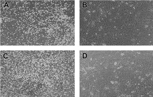 Figure 1. Retroviral expression of AML1b rescues hematopoiesis from AML1-deficient P-Sp regions. Photographs were taken with a Nikon Eclipse TE2000-U (Nikon Sankei, Tokyo, Japan) at a magnification of × 100 after 5 days of culture (A-B) and 14 days of culture (C-D). (A) Hematopoietic cells emerged at day 5 from wild-type P-Sp regions. (B) No hematopoietic cells were observed in the culture of AML1-deficient P-Sp regions, showing only the background of OP9 cells. (C) AML1b-transduced P-Sp regions from an AML1-deficient embryo generated numerous round, nonadherent, or semiadherent cells. (D) A control culture infected with mock virus failed to generate any hematopoietic cells.