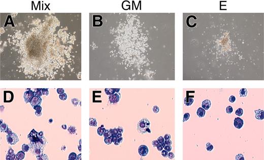 Figure 3. Colony formation of the rescued cells from AML1-deficient P-Sp. The hematopoietic defect of AML1-deficient P-Sp regions was rescued by retroviral expression of AML1b, and the rescued cells were plated into MethoCult3434 medium. The rescued cells generated various types of hematopoietic colonies including definitive origins. Representative hematopoietic colonies by 7 days of culture are shown. (A-C) Morphology of the colonies. (D-F) Cytospin preparation of corresponding cell populations. Cytospins were stained with Wright-Giemsa. Mix indicates mixed colony; GM, granulocyte/macrophage colony; and E, erythroid colony. Photographs were taken with a Nikon Eclipse TE2000-U (Nikon Sankei) at a magnification of × 100.