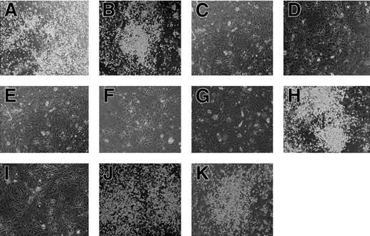 Figure 6. Hematopoietic potential of the AML1 mutants. Cells isolated from AML1-deficient P-Sp regions were infected with retrovirus containing the AML1 mutants. Each retrovirus contained (A) AML1bΔ444, (B) AML1bΔ397, (C) AML1bΔ335, (D) AML1bΔ288, (E) AML1a, (F) AML1bΔRD, (G) AML1bΔ(205-332), (H) AML1bΔ(181-210), (I) AML1b-R139G, (J) AML1b-S249/266A, or (K) AML1b-K24/43R. AML1bΔ444 (A), AML1bΔ397 (B), AML1bΔ(181-210) (H), AML1b-S249/266A (J), and AML1b-K24/43R (K) retain the ability to rescue the hematopoietic defect of AML1-deficient P-Sp regions, whereas other mutants do not. Shown are phase-contrast microscopic views of these cultures at 14 days. Photographs were taken with a Nikon Eclipse TE2000-U (Nikon Sankei) at a magnification of × 100.