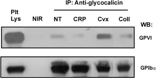 Figure 4. Immunoprecipitation of GPIb-GPVI complexes is increased by treatment of platelets with convulxin. Washed human platelets (5 × 108/mL) were resuspended in HEPES-saline buffer, pH 7.4, containing 10 mM EDTA, and treated with either 20 μg/mL CRP or collagen or 0.5 μg/mL convulxin for 60 minutes, then lysed in the same buffer containing Triton X-100 and proteinase inhibitors as described in “Materials and methods.” Platelet lysates were precleared, mixed with 10 μg/mL of either antiglycocalicin antibody or a nonimmune rabbit control antibody and immune complexes precipitated by mixing with protein A-Sepharose. After washing the beads, captured proteins were eluted in SDS sample loading buffer and analyzed for levels of GPVI by SDS-PAGE and immunoblotting using the anti-GPVI monoclonal antibody, 6B12-3. Blots were stripped and reprobed with the anti-GPIbα monoclonal antibody, WM23. Data are representative of at least 3 experiments with different donors. IP indicates immunoprecipitation; WB, Western blotting; NT, not treated; and NIR, nonimmune rabbit IgG.