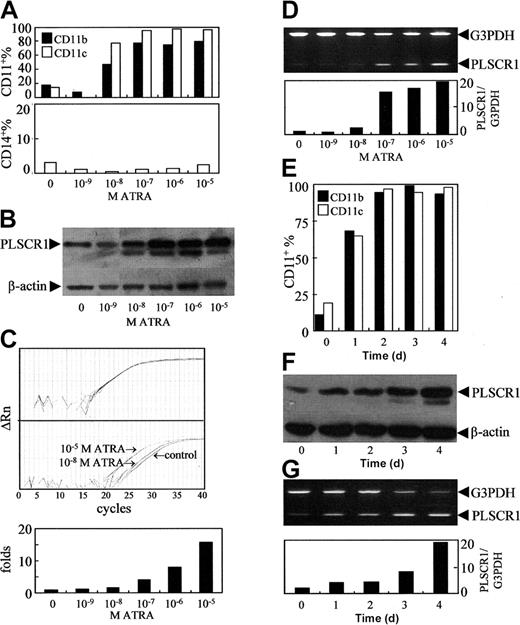 Figure 1. Effects of ATRA on PLSCR1 expression in NB4 cells. NB4 cells were treated with the indicated concentrations of ATRA for 3 days (A-D), or with 10-6 M ATRA for days shown (E-G). CD11b+, CD11c+, and/or CD14+ cells (A,E) were measured by flow cytometry as described in “Materials and methods.” PLSCR1 protein (B,F) was detected by Western blot with β-actin as loading control. PLSCR1 mRNA was detected by real-time quantitative PCR and semiquantitative RT-PCR. (C) Typical amplification plots for PLSCR1 and β-actin showing how their relative expression levels can be assayed by real-time RT-PCR using cDNA template derived by reverse-transcriptase treatment of RNA from a single sample. Upper panel shows that amplification plots for β-actin in different multiplex tubes used to assay PLSCR1 are closely superimposed within experimental error. Middle panel shows amplification plots for PLSCR1 in untreated control, and samples treated with 10-5 M or 10-8 M ATRA; the difference between these assays at the cycle threshold detection line represents the ΔΔCt value when the β-actin results superimpose exactly. Lower panel shows the PLSCR1 mRNA level detected by real-time quantitative PCR under the indicated concentrations of ATRA. For semiquantitative RT-PCR (D,G), the signal intensities of amplified PLSCR1 fragments were normalized against 983-bp G3PDH using a densitometer. Each point represents the mean from triplicate samples with a variance of less than 15%. All experiments were repeated at least 3 times with similar results.