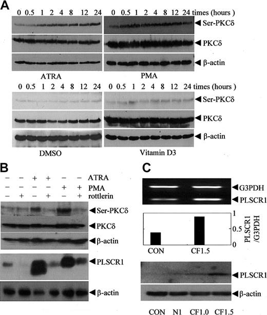 Figure 5. Association of protein kinase Cδ phosphorylation/activation with PLSCR1 expression. (A) After treatment with 10-6 M ATRA, 100 nM PMA, 1% DMSO, or 2.5 × 10-7 M VD3 for the times indicated, NB4 cells were extracted by phosphorylation lysis buffer for Western blots. The blots were probed with antiphospho-PKC-δ (Ser643); then the blots were stripped and reprobed with antibody against PKC-δ. (B, top) After preincubation for 2 hours in the presence or absence of 4 μM rottlerin, NB4 cells were treated with 10-6 M ATRA or 100 nM PMA for 8 hours. After lysis with phosphorylation lysis buffer, equal amounts of total cell lysates were analyzed by Western blot with antiphospho-PKC-δ (Ser643); then the blots were stripped and reprobed with antibody against PKC-δ. (B, bottom) After preincubation for 2 hours in the presence or absence of 1 μM rottlerin, NB4 cells were treated with 10-6 M ATRA or 100 nM PMA for 3 days. After lysis with ice-cold lysis buffer (see “Materials and methods”), equal amounts of total cell lysates were analyzed by Western blot for PLSCR1. In all cases, β-actin served as loading control. Similar results were observed for U937 cells (data not shown). (C) Cos-7 cells were transiently transfected without (CON) or with 1.5 μg empty vector pEGFP-N1 (N1), or 1 μg (CF1, supplemented by 0.5 μg empty vector) and 1.5 μg (CF1.5) pEGFP-CF-PKCδ containing the catalytic fragment of PKCδ. At 48 hours after transfection, semiquantitative RT-PCR (top and middle) and Western blot (bottom) for PLSCR1 were performed.