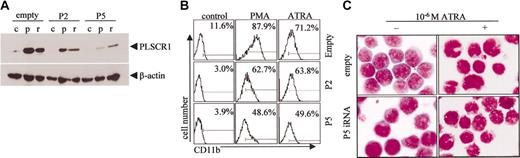 Figure 7. Effects of silencing PLSCR1 expression by siRNA on ATRA/PMA-induced leukemic cell differentiation. U937 cells stably transfected with empty vector or P2/P5 siRNA-carrying vectors were treated without (c) or with 10-6 M ATRA (r) or 100 nM PMA (p) for 3 days. (A) PLSCR1 was detected by Western blot with β-actin as loading control. (B) CD11b+ cells were measured by flow cytometry. In the histograms, each value represents the mean from triplicate samples with a variance of less than 15%. (C) Cells were collected onto slides by cytospin, stained by Wright staining, and observed under microscope (100×/1.30 oil). PMA-induced morphologic differentiation was also inhibited by P5 iRNA (data not shown). All experiments were repeated at least 3 times with similar results.