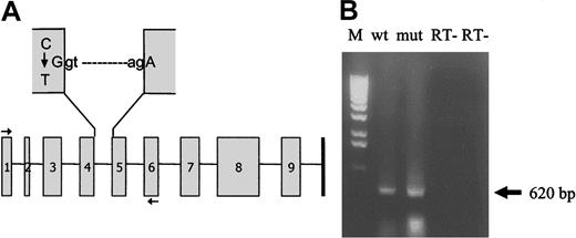 Figure 2. Splicing of wild-type and Arg134Xaa mutant mRNAs. (A) Schematic representation of the FGG gene showing the C>T change in the penultimate base of exon 4 that creates a premature termination codon (TGA) with the first base of exon 5. The horizontal arrows indicate the positions of the oligonucleotide primers used to produce the wild-type and mutant minigenomic constructs for mRNA analysis. (B) RT-PCR analysis of COS-7 cells transfected with wild-type (wt) and Arg134Xaa mutant (mut) minigenomic constructs followed by agarose gel electrophoresis indicates normal splicing for both constructs. The arrow indicates the normal mRNA product (expected size, 620 bp). Sequencing of these RT-PCR products confirmed normal splicing for both wild-type and mutant constructs. M indicates 1-kb DNA ladder marker; RT-, negative controls with heat-inactivated enzymes (“Patients, materials, and methods”).