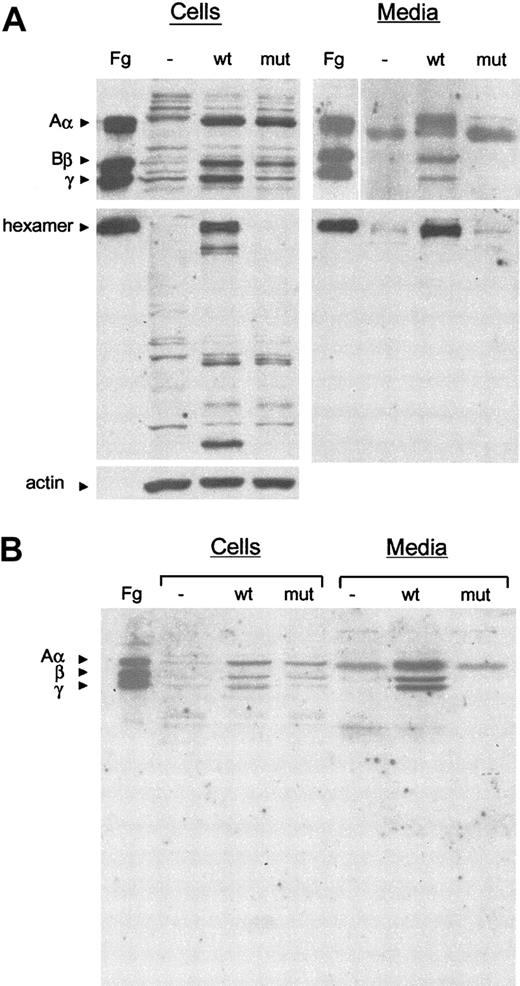 Figure 4. Western blot analysis of cell extracts and conditioned media of COS-7 cells transfected with fibrinogen cDNAs. (A) Samples of cell lysates and culture medium were subjected to 10% SDS-PAGE under reducing conditions (top panels) or 7.5% SDS-PAGE under nonreducing conditions (middle panels). The blots were incubated with polyclonal antihuman fibrinogen or monoclonal anti–β-actin antibodies (as a loading control for cell lysates in reducing conditions; bottom panel), and cross-reacting bands were revealed by chemiluminescence. Fg indicates purified fibrinogen control; -, COS-7 cells transfected with the empty vector; wt, COS-7 cells transfected with normal Aα, Bβ, and γ cDNAs; mut, COS-7 cells transfected with normal Aα, normal Bβ, plus mutant Arg134Xaa γ cDNAs. The positions of the hexameric complex and the normal Aα, Bβ, and γ chains are indicated. (B) Samples of cell lysates and culture medium were subjected to 12.5% SDS-PAGE under reducing conditions with shorter migration times. No truncated γ chain (predicted size, approximately 12 kD) is detectable.