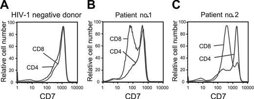 Figure 2. Down-modulation of CD7 preferentially occurs in CD8 T cells in HIV-1 infection. The level of CD7 expression on CD4 and CD8 T cells in healthy individuals not infected with HIV (left panel). CD7 expression is preserved on CD4 T cells in patients with chronic HIV-1 infection (patient no. 1), whereas CD7 is partially down-regulated on CD4 T cells in patients with advanced HIV-1 disease (patient no. 2). Representative data are shown.