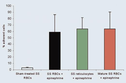 Epinephrine modulates SS RBC adhesion to ECs. See the complete figure in the article beginning on page 3774.