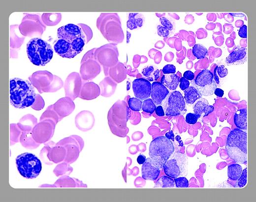 Peter Maslak, Memorial Sloan-Kettering Cancer Center