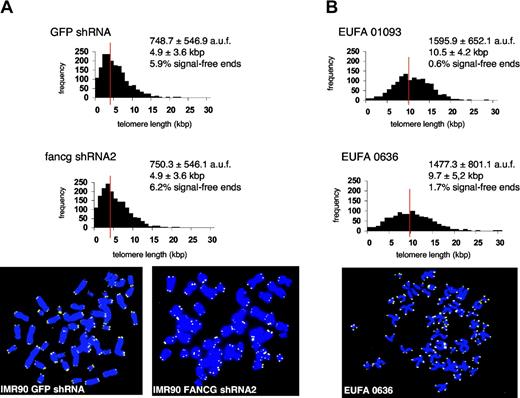Figure 5. Telomere dynamics in FANCG-deficient human cells. (A) Q-FISH analysis of presenescent IMR90 cells infected with retrovirus encoding FANCG shRNAs or GFP shRNA, at day 10 after infection. Histograms show similar telomere length distribution in GFP shRNA IMR90 cells and FANCG shRNA2 IMR90 cells (top 2 panels). Representative microphotographs (telomeric probe, yellow; DNA, blue) are shown in the bottom 2 panels. (B) Telomere length distribution of early-passage primary fibroblasts (CPD5) obtained from 2 FA-G patients (EUFA 1093-F and EUFA 0636). Note the very homogeneous telomere length and absence of signal-free ends or end-to-end chromosomal fusions. A representative microphotograph of a metaphase from patient EUFA 0636 is shown in the bottom panel.