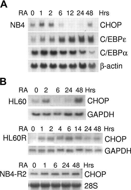 Figure 2. Retinoid-dependent expression of CHOP mRNA in acute leukemia cell lines. NB4, NB4-R2, HL60, and HL60R cells were incubated with ATRA (5 × 10-7 M) for various durations and were harvested for total RNA. Northern blot analyses were performed using total RNA (10-30 μg/lane) and hybridized with 32P-labeled full-length C/EBPα, C/EBPϵ, or CHOP cDNA probes. Blots were stripped and rehybridized with β-actin, GAPDH, or 28S probes to confirm equal loading of the samples. (A) Time-dependent C/EBPα, C/EBPϵ, and CHOP mRNA expression in NB4 cells. (B) Time-dependent CHOP mRNA expression in HL60 cells and retinoid-resistant HL60R and NB4-R2 cells.