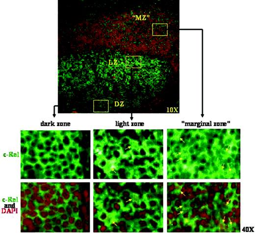 Figure 3. Subcellular distribution of NF-κB in normal B cells. The main effectors of CD40 signaling are NF-κB transcription factors that translocate to the nucleus upon CD40 stimulation. Immunofluorescence was performed for the c-Rel NF-κB subunit on tonsillar sections to identify the cytoplasmic or nuclear localization of NF-κB in normal lymphoid tissues. The upper panel shows a tonsillar GC (magnification 10×). Dark zone (DZ), light zone (LZ), and the equivalent of the marginal zone in tonsil (“MZ”) are indicated. Green represents c-Rel; red, the nuclear counterstaining. The lower panels shows the 3 indicated GC regions at higher magnification (40 ×). In most GC B cells, NF-κB localizes in the cytoplasm: only a subset of CCs in the LZ shows nuclear staining for c-Rel (yellow arrows). Nuclear NF-κB is present in a fraction of cells in the tonsillar equivalent of the MZ that is populated mostly by memory B cells.