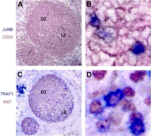 Figure 4. JUNB and TRAF1 expression in normal lymphoid tissues. Serial sections of tonsillar GC were stained with JUNB, CD20, TRAF1, and Ki67 (A,C; magnification 10×). The right panels are enlargements from the light zone (magnification 80×). (A,B) Cells displaying nuclear staining for JUNB (blue) localize in the light zone (LZ) and show costaining for CD20 (brown). (C,D) Ki67 staining (brown) identifies the GC DZ (Ki67high) and LZ. GC cells expressing cytoplasmic TRAF1 (blue) are located mainly in the light zone.