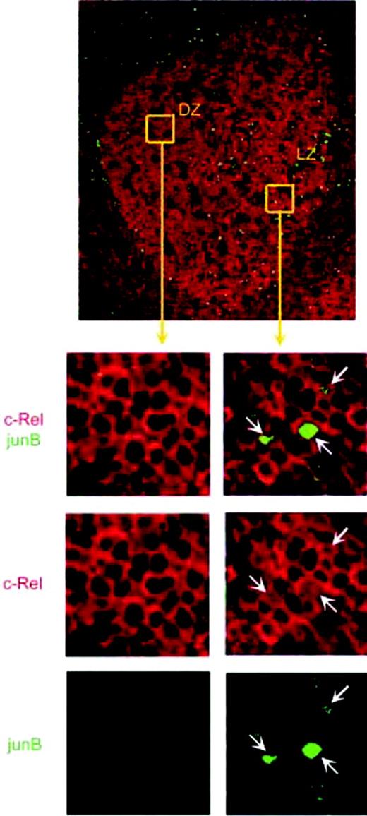 Figure 5. JUNB expression and NF-κB activation in normal B cells. Immunofluorescence was performed for the c-Rel NF-κB subunit (red) and JUNB (green) on tonsillar sections. The upper panel shows a tonsillar GC (10 ×). The lower panels show the indicated GC regions at higher magnification (40 ×). In the DZ, B cells display cytoplasmic localization of NF-κB and absence of JUNB. In the LZ, a subset of CCs shows nuclear staining for c-Rel, and some of those cells coexpress JUNB (arrows).