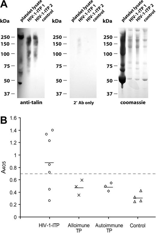 Figure 7. PEG-precipitated ICs from serum of patients with HIV-1-ITP contain talin degradation products, and sera from HIV-1-ITP patients contained anti-talin IgG. (A) Circulating ICs from HIV-1-ITP patients and healthy HIV-1-negative controls were PEG precipitated and analyzed by SDS-PAGE and Coomassie staining or immunoblotting. Talin degradation products in platelet lysate or PEG-ICs were visualized with a murine anti-talin-H mAb, TA205, and a secondary HRP-labeled rabbit anti-mouse IgG F(ab′)2 antibody with minimal cross-reactivity to human serum proteins. No staining was detected with PEG-ICs of healthy controls or with the secondary anti-mouse IgG F(ab′)2 alone. (B) Sera, diluted 1:100 in PBS, from patients with HIV-1-ITP, alloimmune thrombocytopenia (TP), autoimmune thrombocytopenia, and healthy donors were tested for binding to purified talin by ELISA. Bound IgG was detected with an AP-conjugated F(ab′)2 goat antihuman IgG-Fc. Samples with A405 values of more than 2 SD above the mean of alloimmune thrombocytopenia patient values (> 0.7, dashed line) were considered positive. Depicted points are the mean of triplicate determinations.