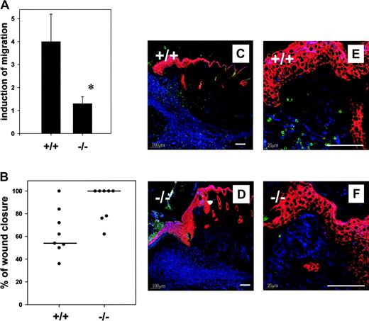 Figure 5. MRP14-/- mice show decreased migration rates of neutrophils during wound healing. (A) Transendothelial migration rates of MRP14+/+ and MRP14-/- granulocytes through a monolayer of bEND5 endothelial cells. Granulocytes were either left untreated or preincubated with arsenite for 30 minutes prior to transendothelial migration to activate p38 MAPK. Bars represent n-fold induction of transmigration rates by arsenite stimulation compared to unstimulated control cells of the appropriate mouse strain. * indicates a statistically significant difference (P ≤ .05). Mean and SD of 5 independent experiments are shown. (B) Mice were wounded as described in “Materials and methods.” The extent of wound closure was determined morphometrically on histologic sections prepared from 5-day old wounds of MRP14-/- mice and MRP+/+ control littermates (8 wounds each). MRP14-/- mice show a significantly accelerated rate of wound closure as compared to MRP14+/+ mice (P ≤ .02). (C-F) Paraffin sections of 5-day-old murine wounds were stained with antibodies directed against cytokeratin 6 (K6, red), cytokeratin 10 (K10, blue), and the granulocyte-specific antigen Ly6G (green), followed by Cy3-, Cy5-, and Cy2-conjugated secondary antibodies, respectively. Panels C and E present sections of MRP14+/+ mice; D and F, sections of MRP14-/- mice at lower (C-D) or higher (E-F) magnifications (bars represent 100 μm). MRP14-/- mice show a significantly lower number of Ly6G+ granulocytes in their granulation tissue. Figures shown are representative for 8 animals from each genotype analyzed.