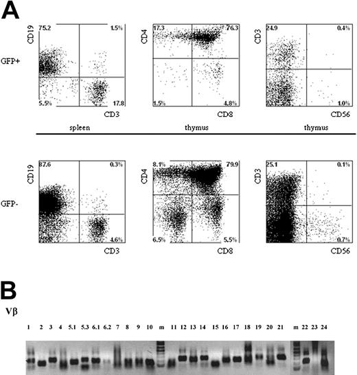 Figure 5. Multilineage presence of GFP+-expressing cells in mice that underwent transplantation with lentivirus-transduced human hematopoietic progenitors. Newborn RAG2-/- γc-/- mice were intraperitoneally injected with human CD34+ hematopoietic stem cells isolated from fetal liver and transduced with the pTRIPΔU3-EF1α p53RNAi lentivirus. (A) Mononuclear cell suspensions from the thymi and spleens of these mice were stained with various human-specific monoclonal antibodies and analyzed by flow cytometry. Cells positive for human CD45 were gated and further analyzed, comparing the GFP+ and GFP- populations. Examples of T-cell development in thymi and spleens are given. Cells were stained with antibodies directed to CD3, CD4, CD8, and CD56 and analyzed by FACS. (B) Vβ family representation from p53i GFP+-expressing T cells in mice that underwent transplantation with lentivirus-transduced human hematopoietic progenitors. RNA was isolated from T cells, and the presence of different Vβ subsets was determined using RT-PCR.