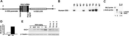 Figure 1. Generation and analyses of TG mice. (A) Construct used for embryo injection. (B) Southern blot from tails of generated mice. Bands (human CD2) indicate the construct integrated in the DNA of TG mice (TG). Bands are absent in wild-type mice (WT). (C) mRNA evaluated by ribonuclease protection assay (RPA). GILZ mRNA levels were analyzed in thymocytes from WT (lane 3) or TG (lane 4) mice. GILZ or β-actin probes are shown in lanes 1 and 2, respectively. (D) Quantitative analysis of RPA experiment shown in panel C. (E) Western blot of GILZ protein levels in thymocytes from WT mice left untreated (control, C; lane 1) or treated with 0.01, 0.1, 1, or 10 mg/kg DEX (lanes 2, 3, 4, and 5, respectively) or in thymocytes from 3 TG mice (TG no. 1, TG no. 2, TG no. 3).