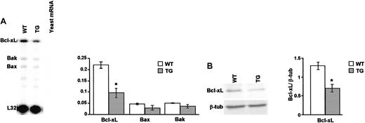 Figure 4. Thymocyte Bcl-xL expression. (A) RPA analysis shows mRNA levels of Bcl-xL, Bak, and Bax from a representative experiment. Bars represent quantitative analysis of Bcl-xL (Bcl-xL/L32 mRNA ratio), Bax (Bax/L32 mRNA ratio), or Bak (Bak/L32 mRNA ratio) mRNA levels in WT and TG thymocytes from 3 independent experiments. (B) Western blot analysis of Bcl-xL (labeled “Bcl-xL”) and β-tubulin (“β-tub”) proteins and, on the right, the quantitative analysis (bcl-xL/β-tubulin ratio) of WT and TG thymocytes from 3 independent experiments. Bars represent the mean values ± 1 SEM. *P < .05.