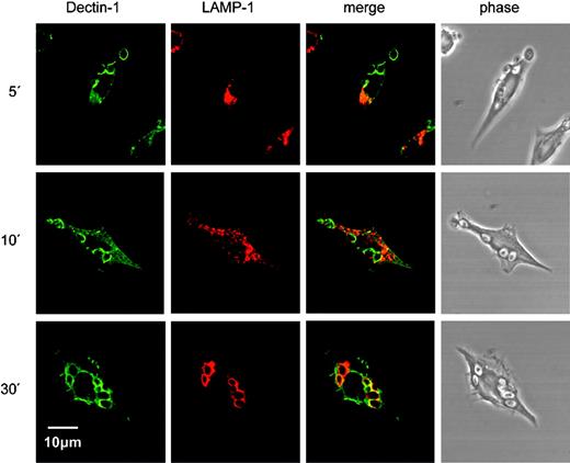Figure 6. Dectin-1 traffics to lysosomes after zymosan binding and internalization. A time course of confocal images following the synchronous phagocytosis of zymosan in RAW 264.7 cells stably expressing HA-tagged Dectin-1 is shown. Cells were fixed, permeabilized, and stained to visualize Dectin-1 (green) and the late endosomal/lysosmal compartment marker LAMP-1 (red), using an APO oil immersion lens at 60× magnification, 1.4 NA. Zymosan phagosomes started becoming LAMP-1+ by 10 minutes and showed extensive colocalization of Dectin-1 and LAMP-1 by 30 minutes. The images are representative of 3 separate time-course experiments.