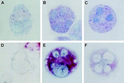 Figure 3. Effect of LPA on histochemical characteristics of hMCs. (A-C) Toluidine blue staining and (D-F) immunocytochemistry for tryptase of representative hMCs developed in the presence of SCF, IL-6, and IL-10 in serum-free medium (A, D) without and (B, E) with 5.0 μm LPA, and (C, F) under standard serum-supplemented conditions. All cultures were 3 weeks old at the time of analysis. Data are from 1 of 2 representative experiments. Images depicted are 400 × magnifications.