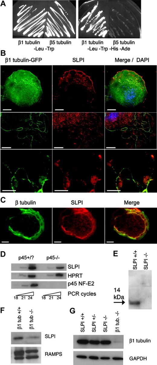 Figure 1. SLPI is expressed in megakaryocytes, binds specifically to β1 tubulin, and is reduced in platelets lacking β1 tubulin. (A) SLPI binds to β1 tubulin but not to the homologous β5 tubulin isotype in yeast 2-hybrid assays. Cells transformed with β5 tubulin fail to grow on His-Ade- selection medium, whereas growth of β1 tubulin-transformed cells indicates that SLPI and β1 tubulin interact and activate the reporter genes. Other transformants (not shown) with β5 tubulin grew on His-Ade- media and served as positive controls. (B) Immunofluorescence (IF) analysis of primary MKs expressing a β1 tubulin-GFP fusion protein. Cellular SLPI is detected by a specific antibody and Texas red-labeled secondary antibody. Merger of IF signals, including nuclear DAPI staining, is displayed in the third column, and each row represents different cells. Scale bars, 10 μm. (C) Double-label IF of primary MKs with β-tubulin (green) and SLPI (red) Ab, showing significant colocalization in the merged image. (D) SLPI mRNA is expressed in normal (p45+/?) primary MKs and reduced in p45 NF-E2-/- cells, as judged by semiquantitative RT-PCR over the indicated number of PCR cycles. (E) SLPI appears as a 14-kDa protein in platelet lysates, as shown by immunoblotting using a specific antibody. No signal is detected in SLPI-/- platelet lysates. (F-G) SLPI expression is reduced in β1 tubulin-/- platelets, whereas absence of SLPI does not affect β1-tubulin levels. Equal loading of wild-type and mutant platelets was verified by staining with antisera against whole mouse platelets (RAMPS) or glyceraldehyde 3-phosphate dehydrogenase (GAPDH).