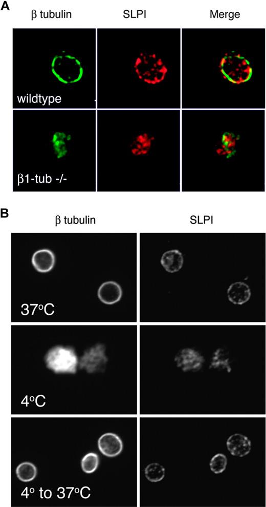 Figure 2. SLPI is present in 2 distinct platelet compartments, including a β1 tubulin-dependent association with intact marginal band microtubules. (A) SLPI is found in 2 distinct compartments in normal resting platelets: a punctate distribution in the platelet body that suggests expression in granular stores, and a peripheral distribution wherein SLPI (red) colocalizes with β tubulin (green), as shown by the yellow color in the merged image. Only the latter distribution depends on β1 tubulin, as revealed by its loss in β1 tubulin (β1 tub)-null platelets. (B) The peripheral SLPI distribution depends on the presence of polymerized MTs: in cooled platelets (4°C) MTs depolymerize, losing both the marginal band together and peripheral SLPI staining (middle panels). Rewarmed platelets reconstitute the peripheral MT coil and restore native SLPI distribution (lower panels).
