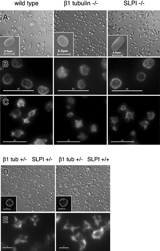 Figure 4. SLPI is dispensable for platelet discoid shape and resting integrity or activation-induced reorganization of the marginal MT band. (A) Differential interference contrast (DIC) and scanning electron (SEM, insets) microscopy reveal the elliptical shape of resting wild-type and SLPI-/- platelets, whereas β1 tubulin-/- platelets are spherical. (B) IF microscopy after staining with β-tubulin antibody reveals a normal marginal MT band in SLPI-/- platelets, in contrast to β1 tubulin-/- platelets, which have an indistinct marginal band. (C) Washed platelets were deposited on coverslips and stimulated with thrombin for 5 minutes prior to fixation. SLPI-/- platelets show normal contraction of the marginal band and short MT protrusions, similar to wild-type platelets, whereas β1 tubulin-/- platelets have a diminished resting marginal band that is defective in reorganization. (D-E) Platelets from compound SLPI+/- β1 tubulin+/- mice and control SLPI+/+ β1 tubulin+/- mice show normal discoid cell shape by DIC microscopy (D), intact marginal MT bands in β-tubulin IF (insets), and the normal MT morphology after thrombin stimulation. Scale bars: B-C, 10 μm; D-E, 2 μm.