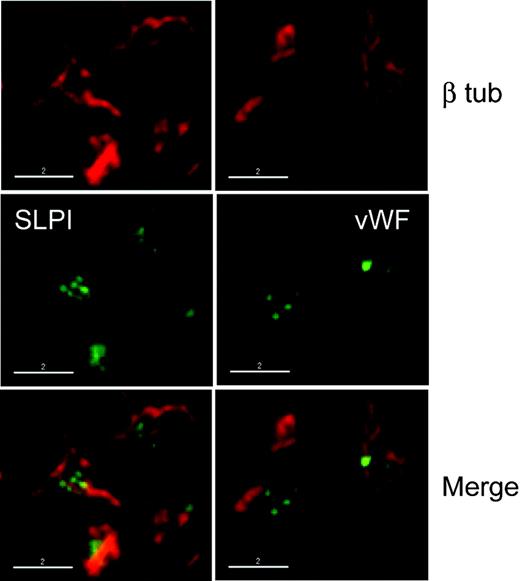 Figure 5. SLPI loses microtubular association after thrombin stimulation. Thrombin-stimulated wild-type platelets were stained with antibodies against β tubulin and either SLPI or the α-granule marker VWF. Following activation, SLPI is restricted to a single, central platelet compartment, similar to VWF, and, in contrast to resting platelets (see Figure 2A), no longer colocalizes with the rearranged MT filaments. Scale bars, 2 μm.