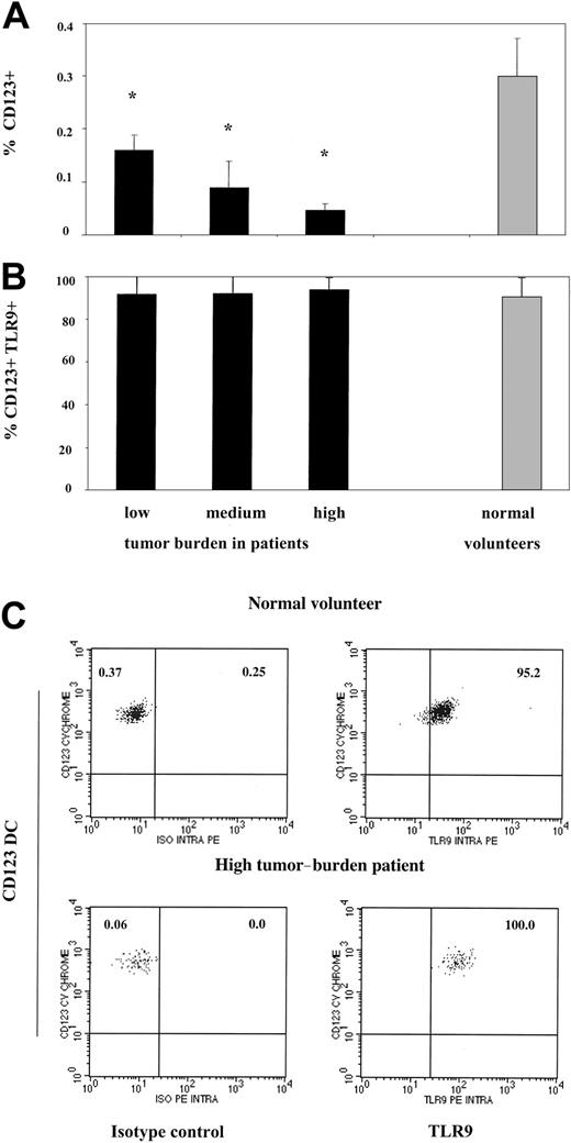 Figure 1. CD123 plasmacytoid dendritic cells from Sezary syndrome patients are decreased in numbers but express normal levels of TLR9. (A) PBMCs from SS patients with low (n = 5), medium (n = 4), and high (n = 4) peripheral blood tumor burdens and healthy volunteers (n = 6) were excluded of all lineage-positive cells (Lin 1-FITC cocktail), and lineage-negative cells were analyzed for the co-expression HLADR and CD123. Data represent means (± SD) of tested individuals and are presented as a percentage of all PBMCs gated on live cells. (B) PBMCs from SS patients and healthy volunteers were stained as described in panel A, but lineage-negative cells were analyzed for the co-expression of HLADR, CD123, and TLR9 or isotype control antibody. Control antibody stained 0.1% to 0.3% of PBMCs (data not shown). Data represent means (± SD) of tested individuals and are presented as a percentage of CD123 DCs expressing TLR9. *P < .05 compared with healthy volunteers. (C) PBMCs from a representative healthy volunteer (top row) and high tumor burden patient (bottom row) were stained as described in panels A and B. The left upper quadrant numbers of panels on the left represent the percentage of dendritic cells in the healthy volunteer (percentage of all PBMCs gated on forward and side light scatter) and the patient, whereas the right upper quadrant numbers represent the percentage of CD123 DCs stained with isotype control. The right upper quadrant numbers of the panels on the right represent percentage of CD123 DCs positive for TLR9 in the healthy volunteer (top row) and the patient (bottom row).