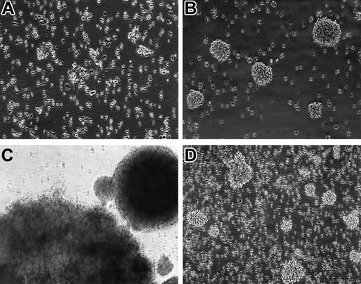 Figure 1. Photomicrographs of human PBMCs in cultures infected with M fermentans (Mi strain). (A) PBMCs cultured in suspension without infection of mycoplasma for 5 days. Some macrophages attached to the surface of the flask. (B) PBMC culture infected by mycoplasma for 4 weeks. Small clumps of cell aggregates were found in culture, and these cells later became immortalized. (C) PBMCs in a culture infected by mycoplasma for 8 weeks. The rapidly proliferating cells formed large cell aggregates. (D) PBMCs immortalized by mycoplasmal infection after 4-month culture. Many of the rapidly dividing cells became individually separated, many others aggregated into small clumps. Original magnification × 100 (A-B,D) and × 40 (C). The images were captured on an inverted phase contrast microscope Nikon Diaphot (Nikon, Tokyo, Japan) equipped with a Polaroid camera Nikon UFX-II and Photo Eyepiece objective lens CF PL 2.5× (Nikon). Original magnification was × 80 (A, B, D) and × 40 (C), under an achromatic objective lens with numerical aperture of 0.4 and 0.3, respectively.
